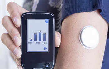 Image What is regular monitoring in Diabetes?