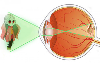 Image What is retinopathy of prematurity (ROP)?