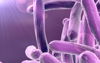 Image What is the diagnosis of Mycobacterium tuberculosis?