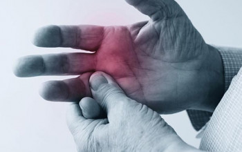 Image What is Rheumatoid Arthritis?