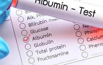 Image What you need to know about Albumin Test