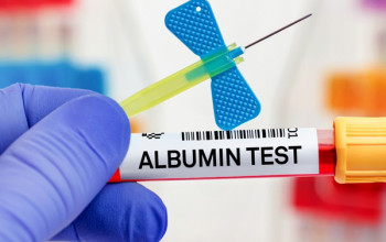 Image एल्ब्यूमिन रक्त परीक्षण क्या है?| Albumin Blood Test in Hindi
