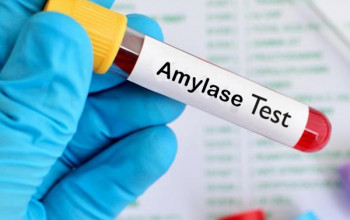 Image एमाइलेज टेस्ट क्या है? | Amylase Test in Hindi