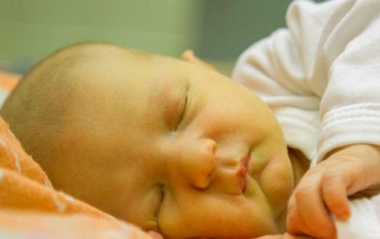 Image नवजात शिशुओं में पीलिया – कारण, लक्षण और इलाज | Newborn Jaundice Causes in Hindi