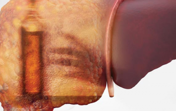 Image Liver Failure: Causes, Symptoms, and Treatment