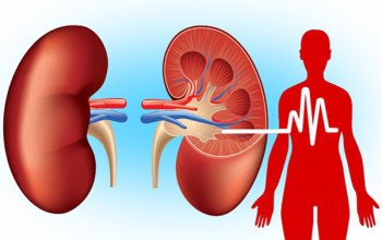 Image I have CKD and hypertension - Can pain killers worsen my condition?