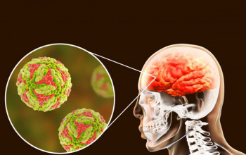 Image Should every case of encephalitis be treated?