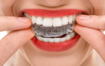 Image How to Straighten Teeth | Medtalks
