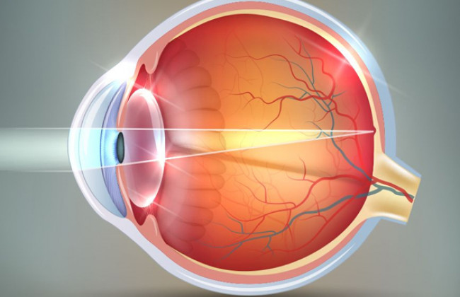 Image Common Eye Conditions and Diseases