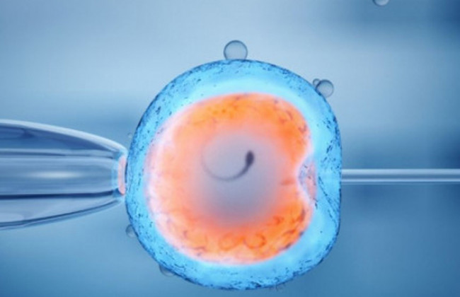Image Fresh V/s frozen sperm for frozen donor egg IVF