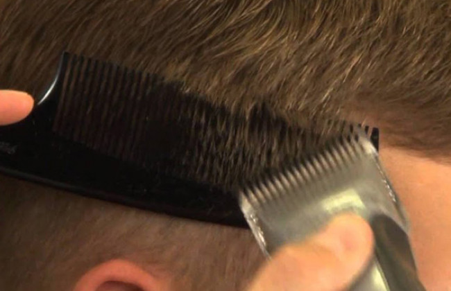 Image Is it necessary to cut hair with a razor before any surgery?
