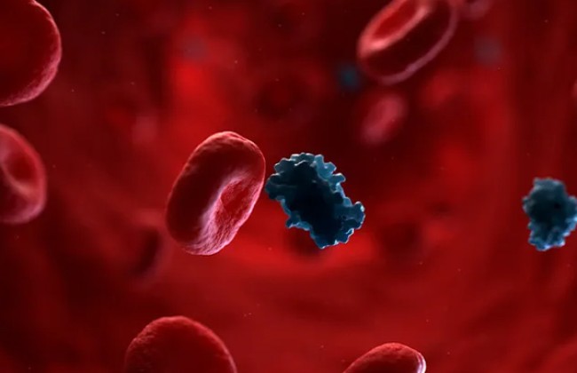 Metabolic Syndrome & Its Management