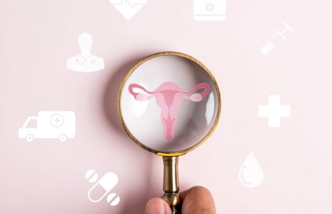 Image 5 Myths about PCOS by Dr Laxmi Shweta Karlapudi in English