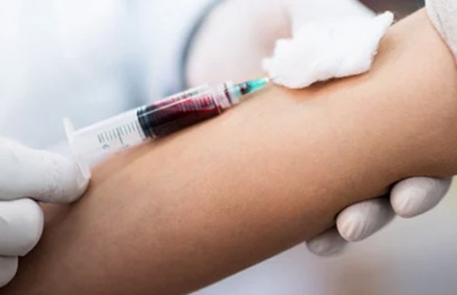 Serum Calcium Blood Tests and Their Clinical Relevance
