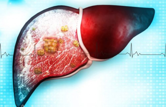 Image Liver Diseases in Special Populations (Children, Elderly, and Pregnancy)
