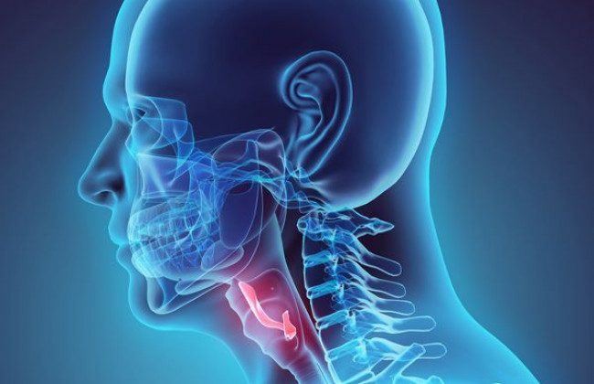 Image एपिग्लोटाइटिस क्या है? कारण, लक्षण और इलाज | Epiglottitis in Hindi