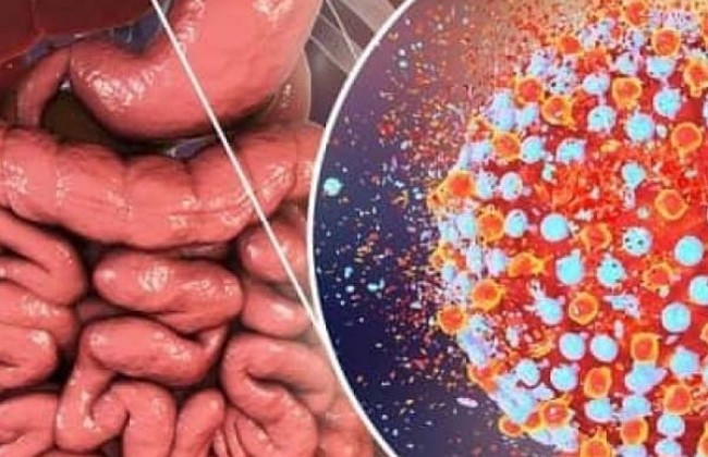 हेपेटाइटिस ई क्या है? कारण, लक्षण और इलाज | What is Hepatitis E in Hindi