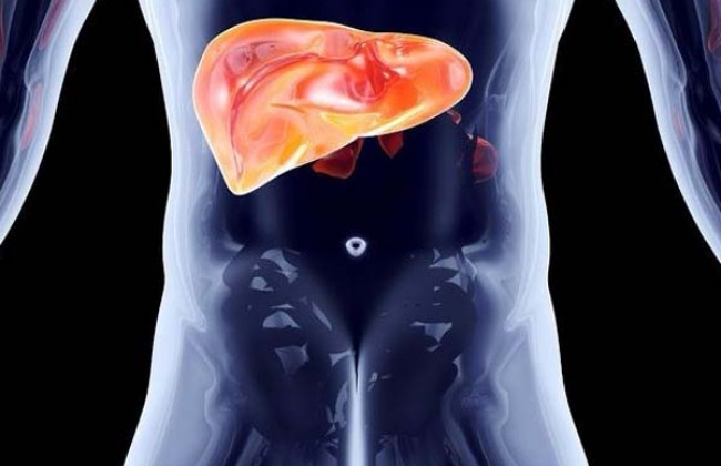 Image Liver Inflammation: Causes, Complications and Treatment Approaches