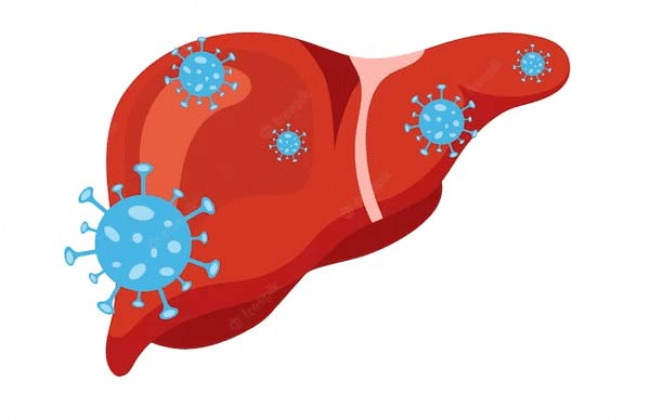 Image हेपेटाइटिस सी क्या है? कारण, लक्षण और इलाज | What is Hepatitis C in Hindi