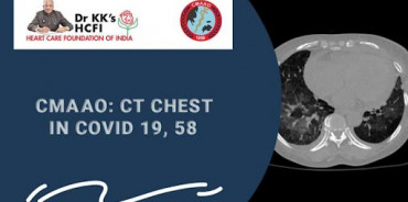 CMAAO Meeting: CT Chest in COVID 19 , 58- An Update from CMAAO