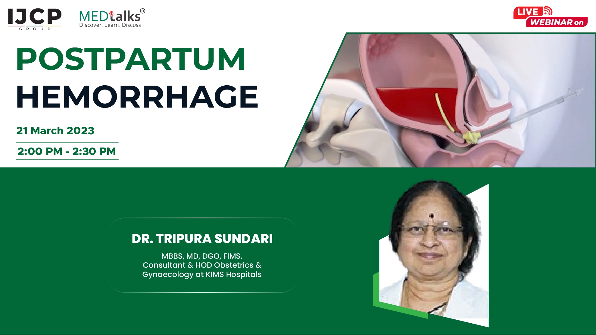Postpartum Hemorrhage- An informative discussion with Dr. Tripura Sundari
