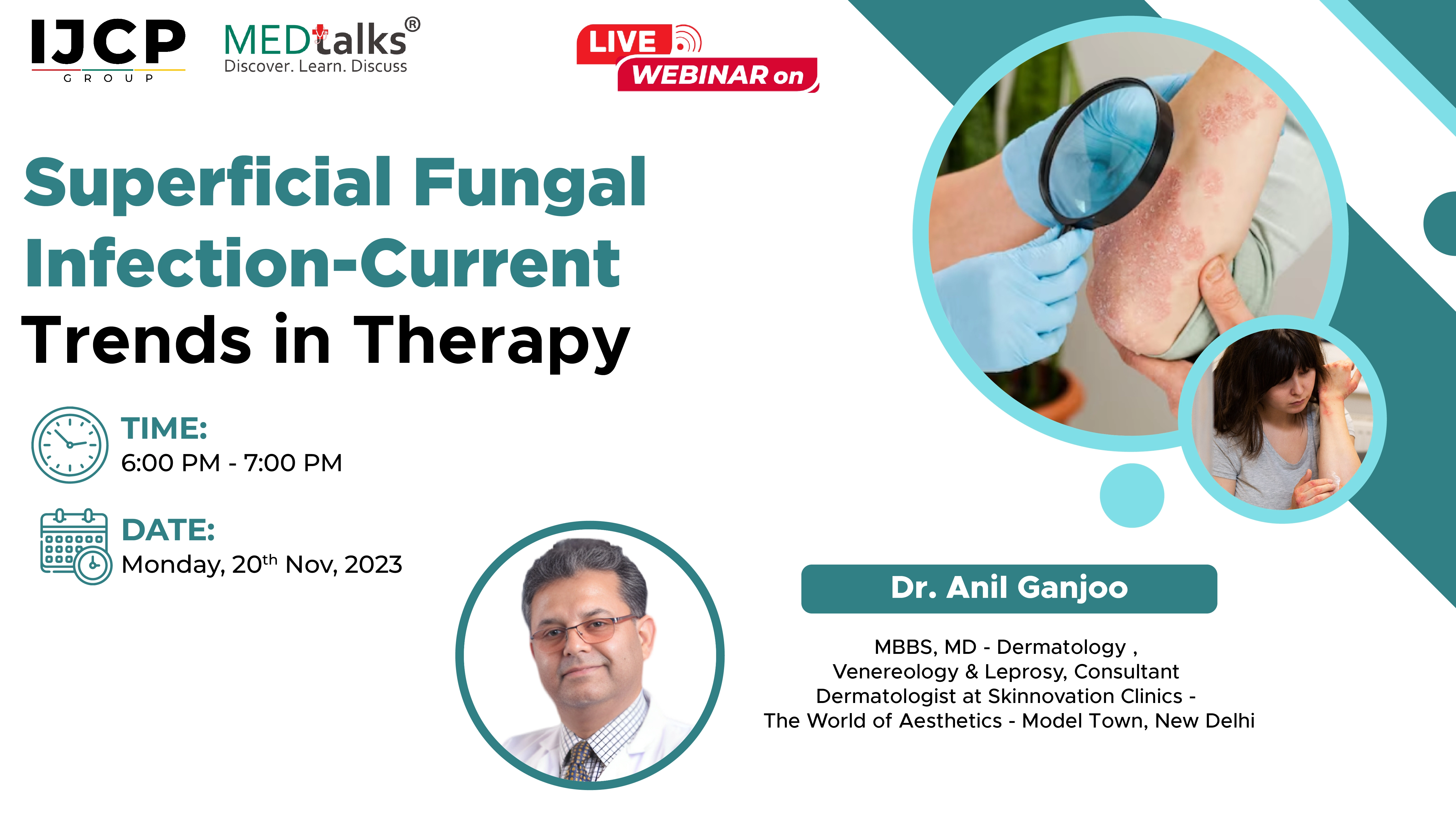 Superficial Fungal Infection- Current Trends in Therapy