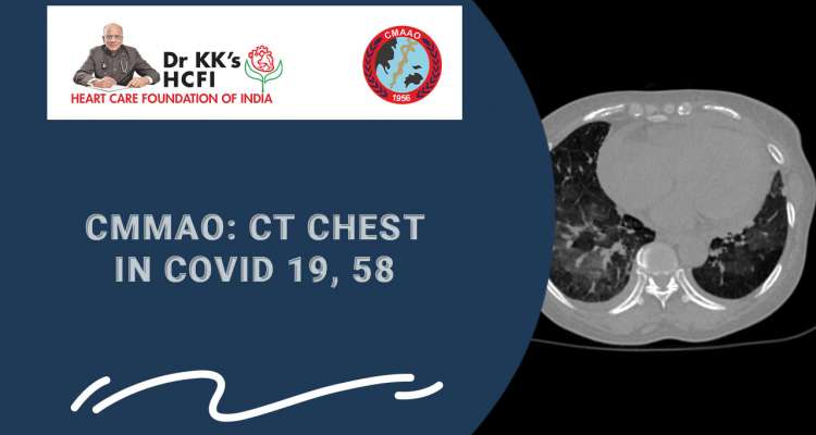 CMAAO Meeting: CT Chest in COVID 19 , 58- An Update from CMAAOO