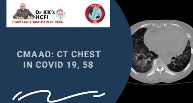 CMAAO Meeting: CT Chest in COVID 19 , 58- An Update from CMAAO