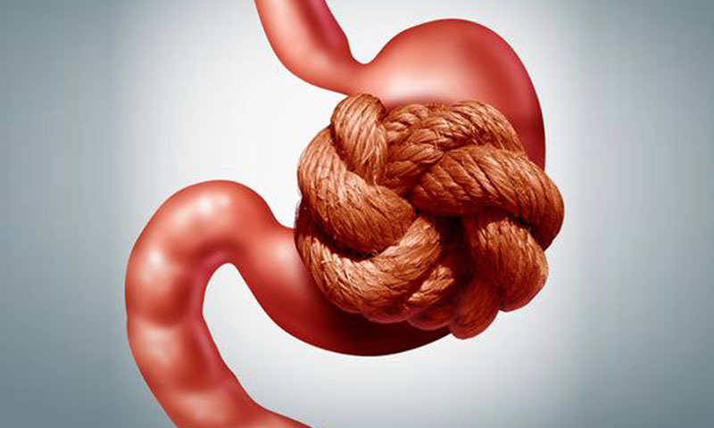 Chronic Constipation