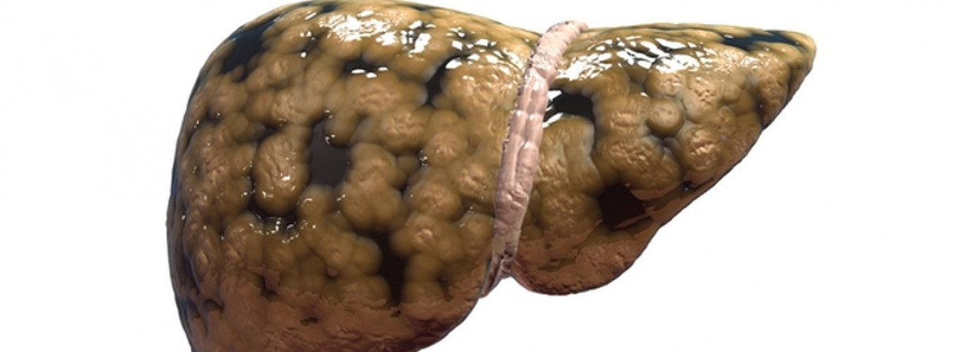 Fatty Liver Disease