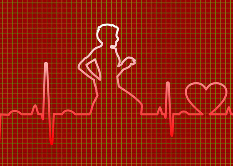 Understanding ECG and Hyperlipidemia