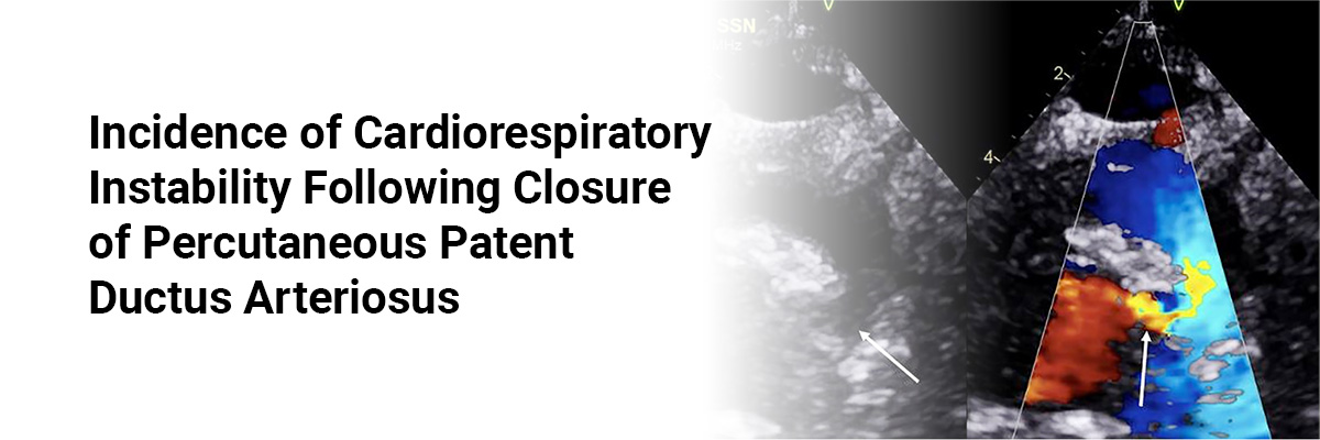 Incidence of Cardiorespiratory Instability Following Closure of Percutaneous Patent Ductus Arteriosus 
