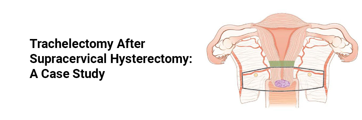 Trachelectomy After Supracervical Hysterectomy: A Case Study