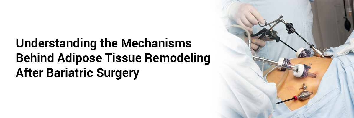 Understanding the mechanisms behind adipose tissue remodeling after bariatric surgery