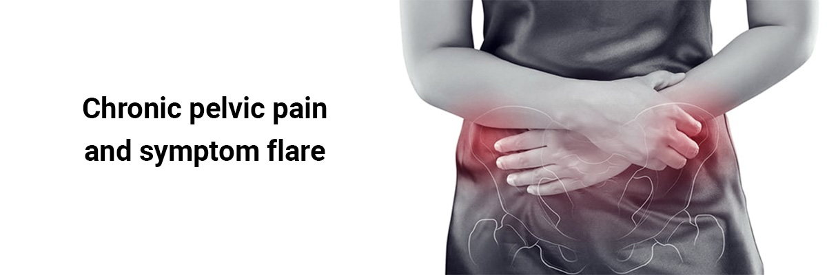 Chronic pelvic pain and symptom flare 