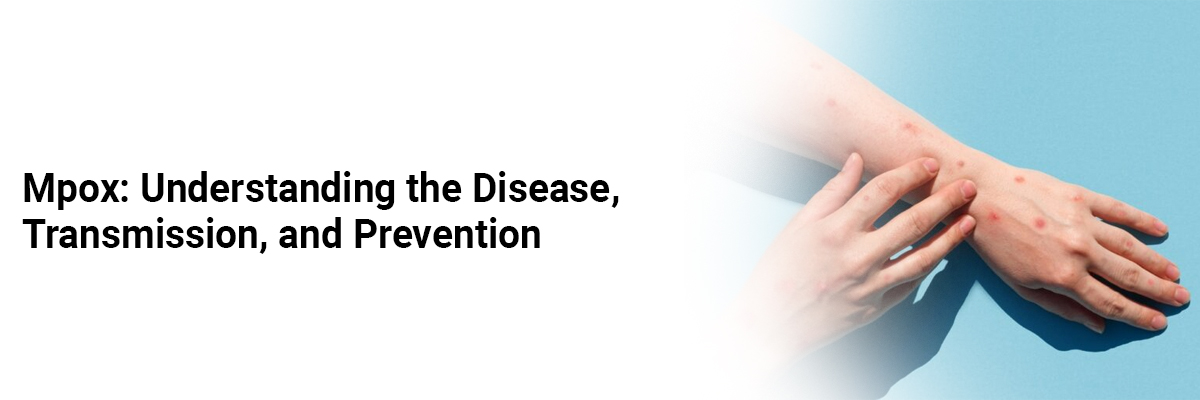 Mpox: Understanding the Disease, Transmission, and Prevention