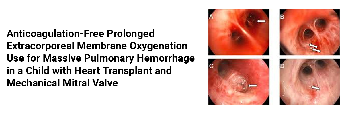 Anticoagulation-free Prolonged Extracorporeal Membrane Oxygenation Use for Massive Pulmonary Hemorrhage in a Child with Heart Transplant and Mechanical Mitral Valve