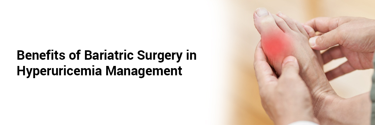 Benefits of bariatric surgery in hyperuricemia management