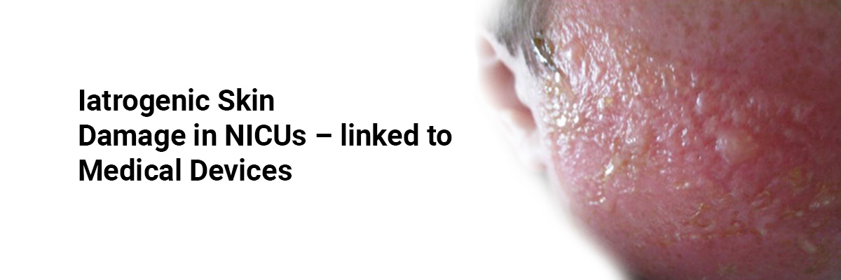 Iatrogenic skin damage in NICUs – linked to medical devices
