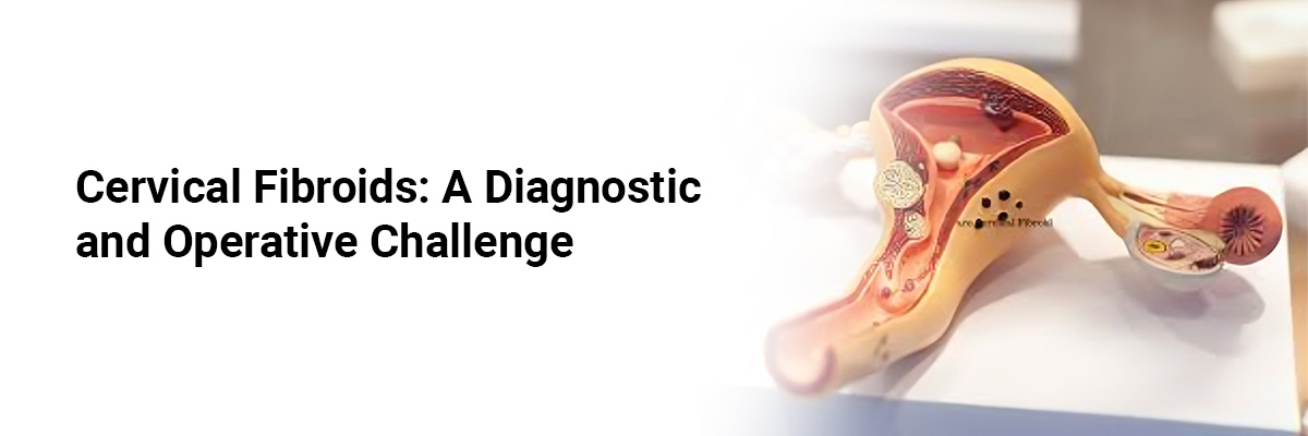 Cervical fibroids: A diagnostic and operative challenge