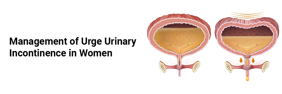 Management of Urge Urinary Incontinence in Women 