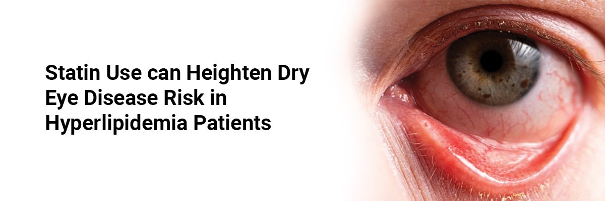 Statin use can heighten dry eye disease risk in hyperlipidemia patients