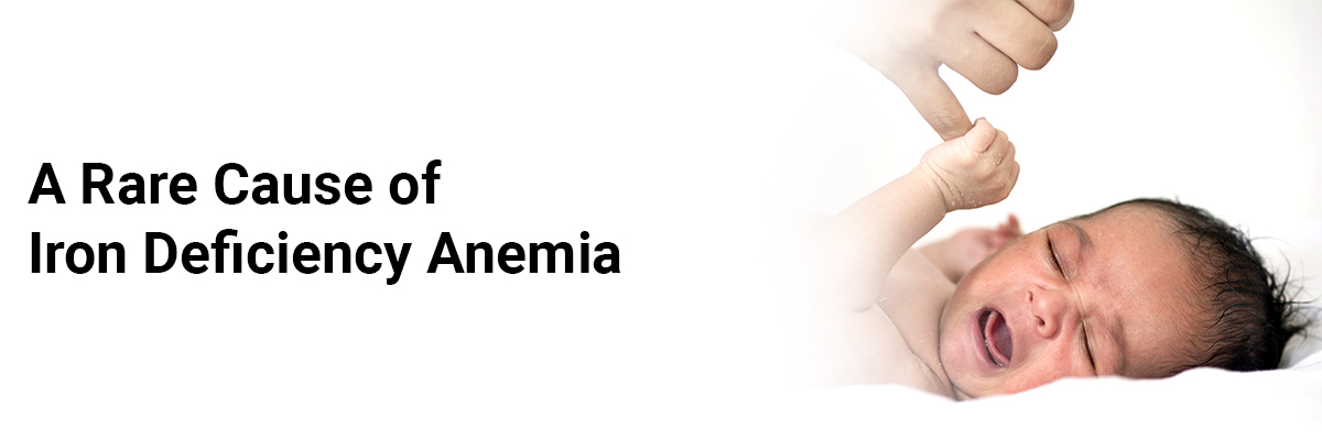 A Rare Cause of Iron Deficiency Anemia
