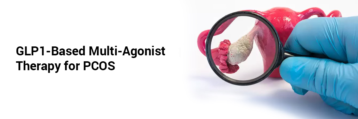GLP1-based multi-agonist therapy for PCOS