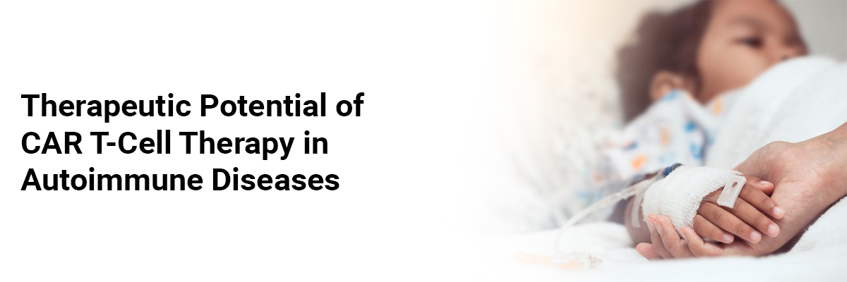 Therapeutic potential of CAR T-Cell Therapy in Autoimmune Diseases
