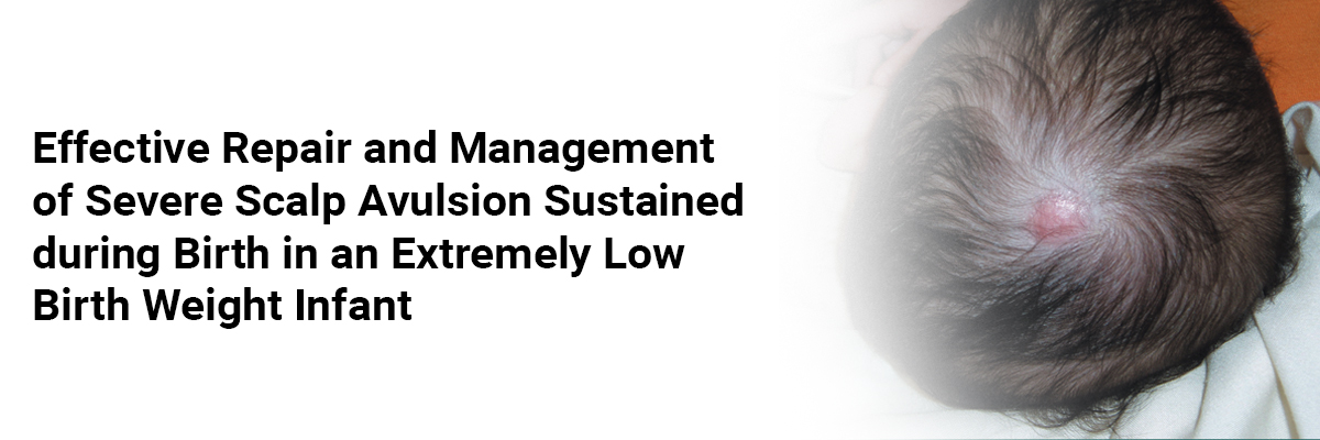 Effective Repair and Management of Severe Scalp Avulsion Sustained during Birth in an Extremely Low Birth Weight Infant
