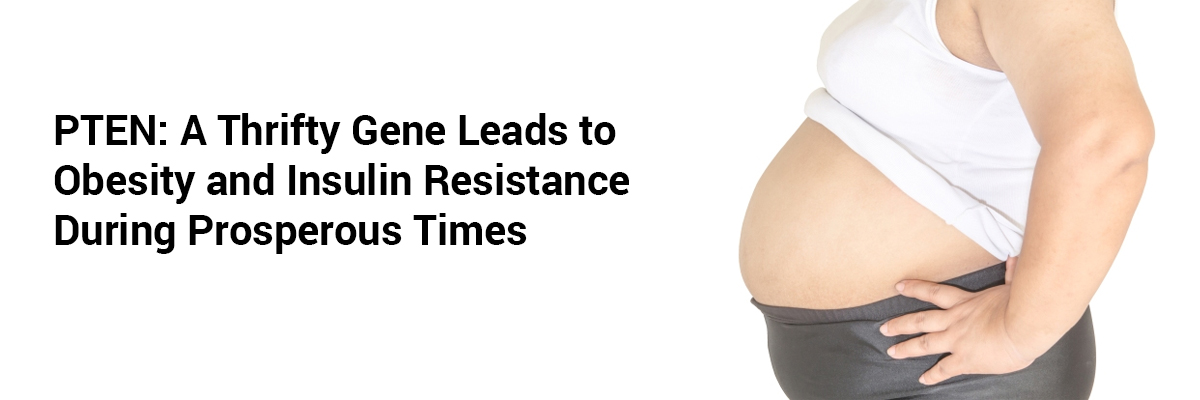 PTEN: A Thrifty Gene Leads to obesity and Insulin resistance During Prosperous Times