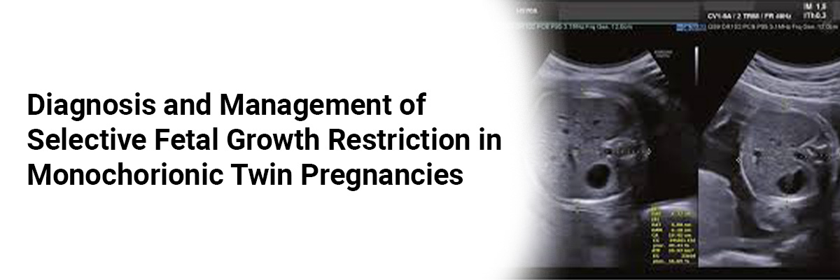 Diagnosis and management of Selective fetal growth restriction in monochorionic twin pregnancies