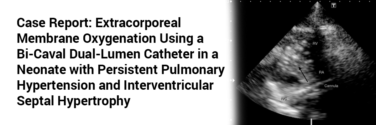 Case report: Extracorporeal Membrane Oxygenation Using a Bi-Caval Dual-Lumen Catheter in a Neonate with Persistent Pulmonary Hypertension and Interventricular Septal Hypertrophy