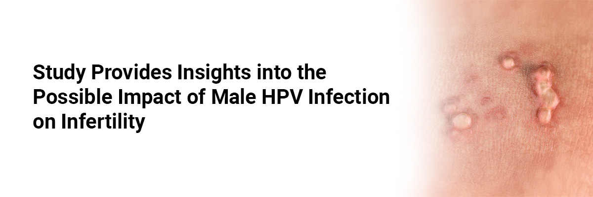 Study Provides Insights into the Possible Impact of Male HPV Infection on Infertility
